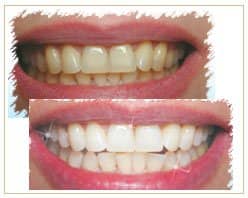 Slider image (5) Bangkok Dental Image